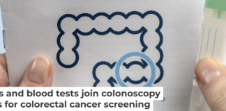 Screening is essential to prevent and effectively treat colorectal cancer. Varlay/iStock via Getty Images Plus